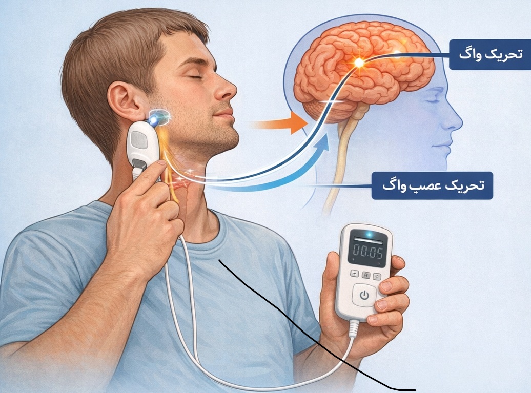 تحریک غیرتهاجمی عصب واگ چیست؟